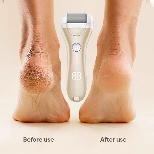 SAKER® Electric Callus Remover