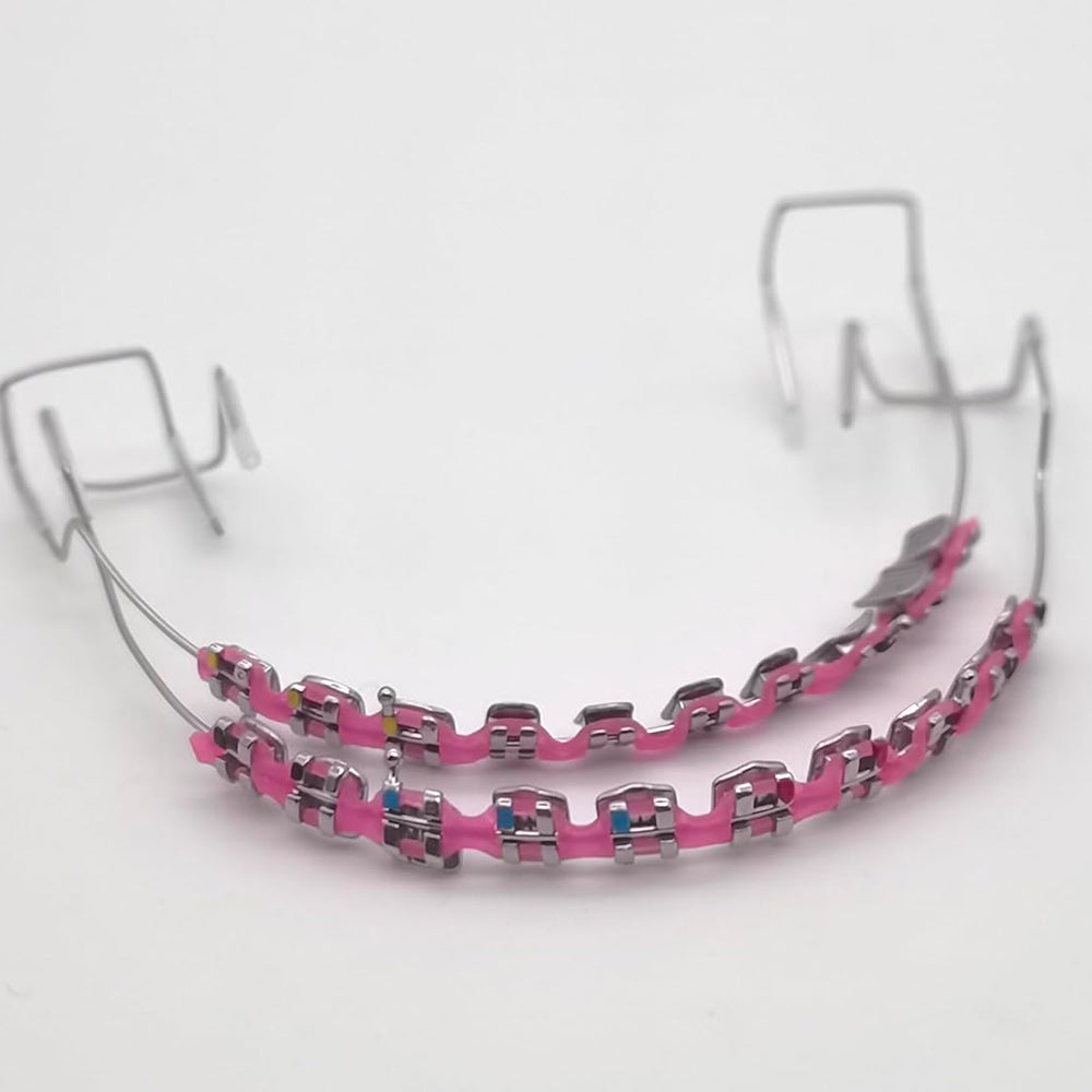 Sakerplus One-Step Fake Braces with Power Chain