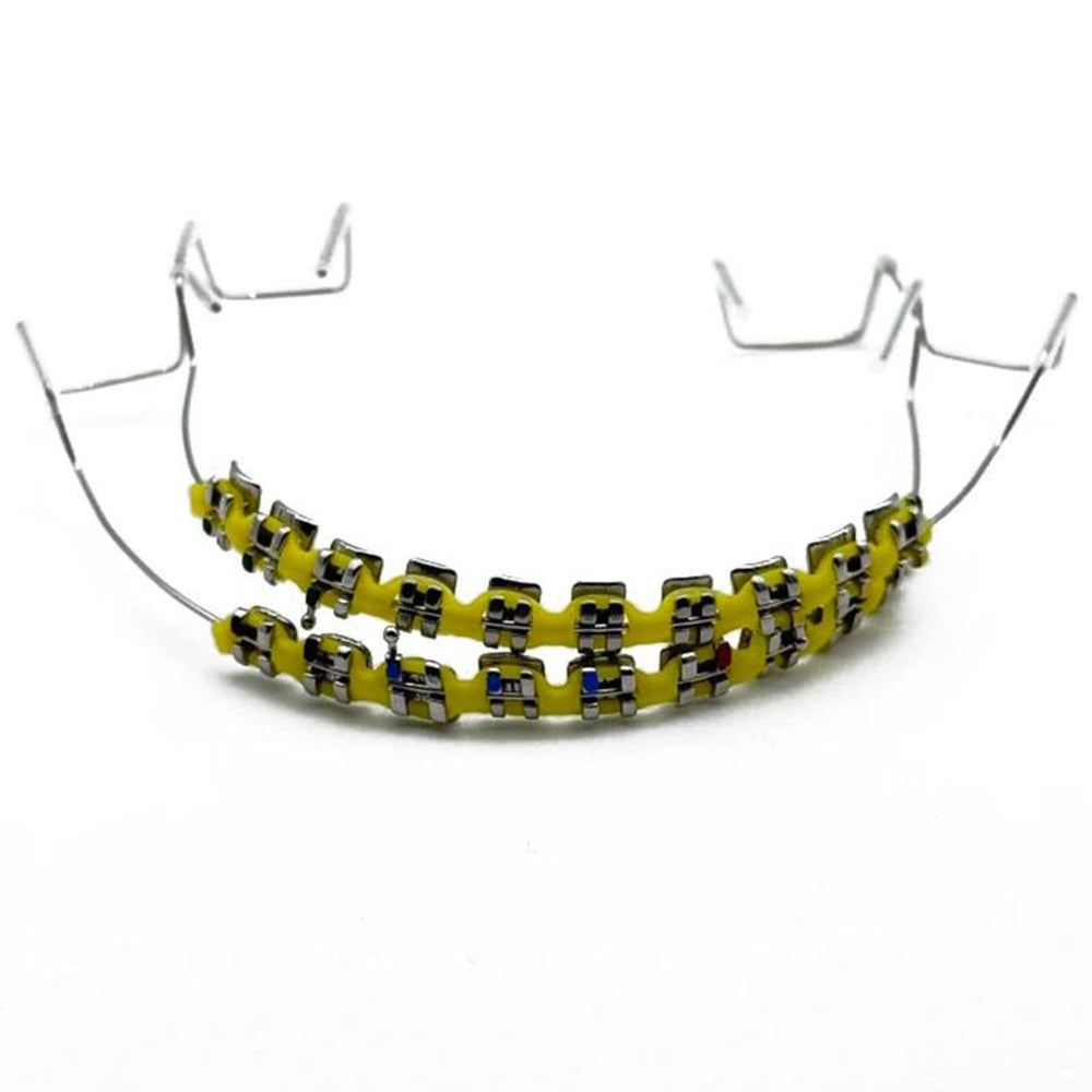 Sakerplus One-Step Fake Braces with Power Chain