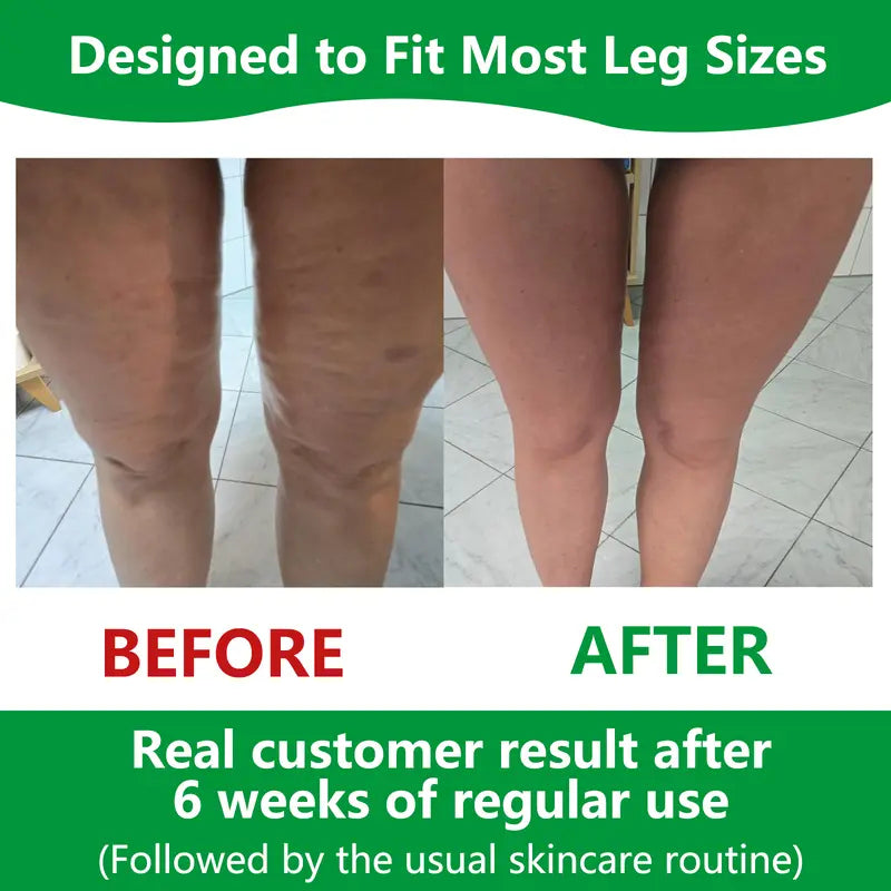 Sakerplus Cellulite Massage Roller