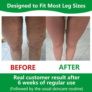 Sakerplus Cellulite Massage Roller