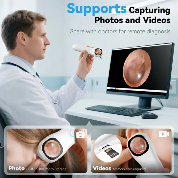 Sakerplus® 1080P HD Digital Otoscope With Screen