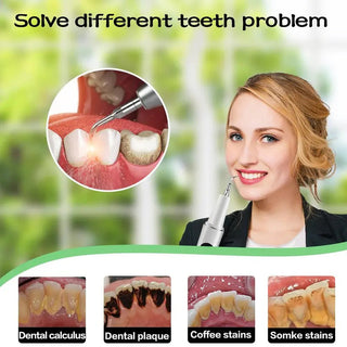 Sakerplus® Rechargeable Electric Teeth Plaque Remover