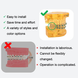 Sakerplus One-Step Fake Braces with Power Chain