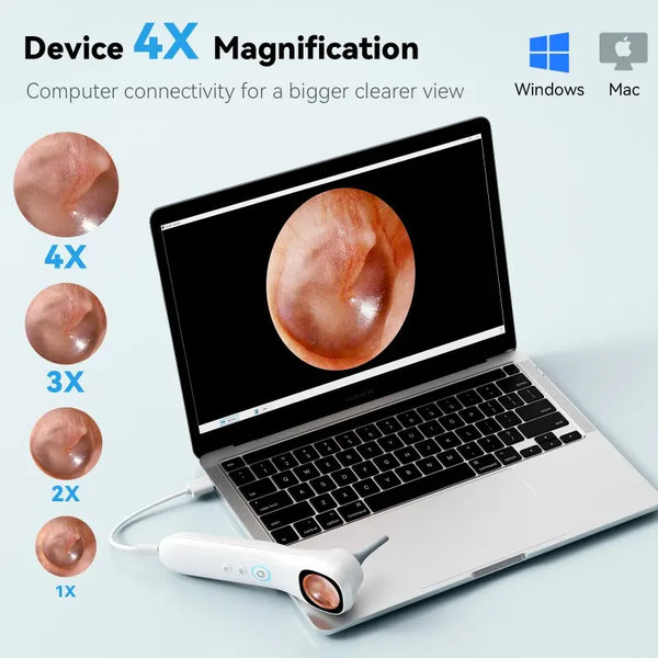 Sakerplus® 1080P HD Digital Otoscope With Screen
