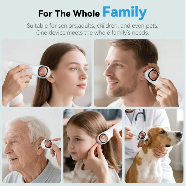 Sakerplus® 1080P HD Digital Otoscope With Screen