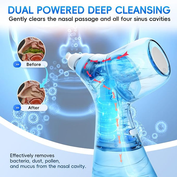 Sakerplus® Electric Nasal Irrigation Sinus Rinse Machine