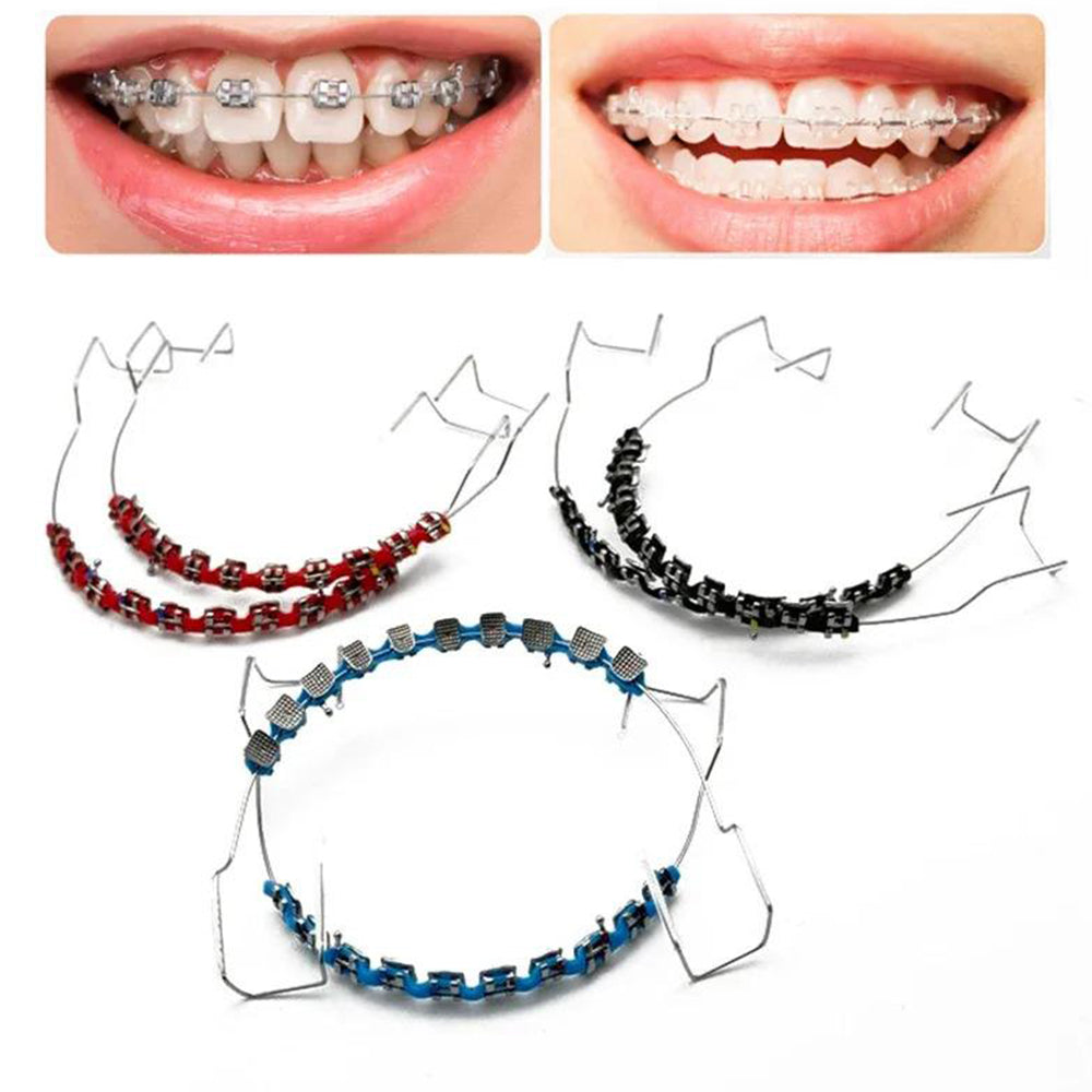 Sakerplus One-Step Fake Braces with Power Chain