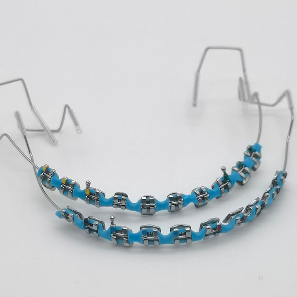Sakerplus One-Step Fake Braces with Power Chain