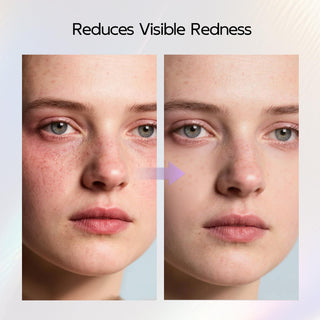 Sakerplus Red Light Therapy Face And Neck Mask